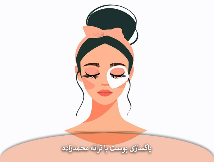 فیشال دور چشم