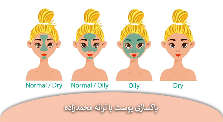 تایپ‌های پوستی