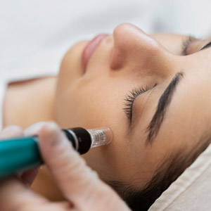 میکرونیدلینگ رفع جای جوش در پاکسازی پوست ترانه محمدزاده