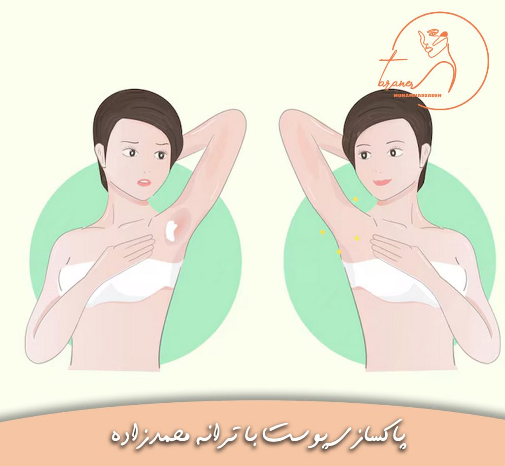 تیرگی زیریربغل