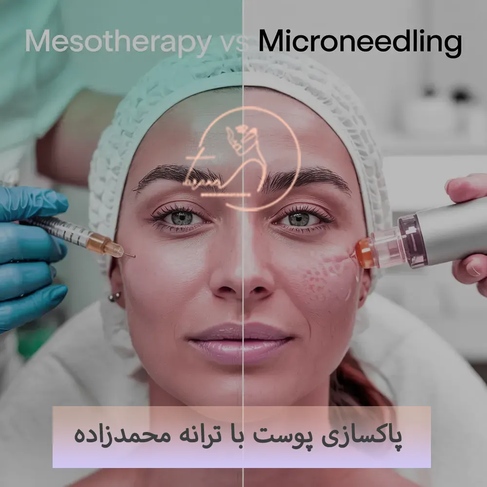 خدمات مزونیدلینگ با ترانه محمدزاده2-4