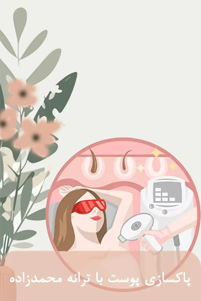 تفاوت دستگاه لیزر شاتی و رولی