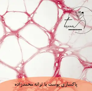بافت همبند: ساختار، انواع و عملکرد-ترانه محمدزاده