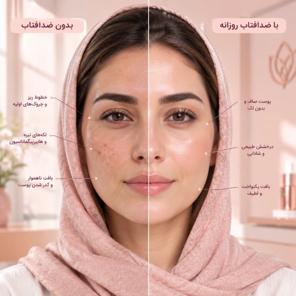 چرا ضدآفتاب برای همهی انواع پوست ضروریه؟